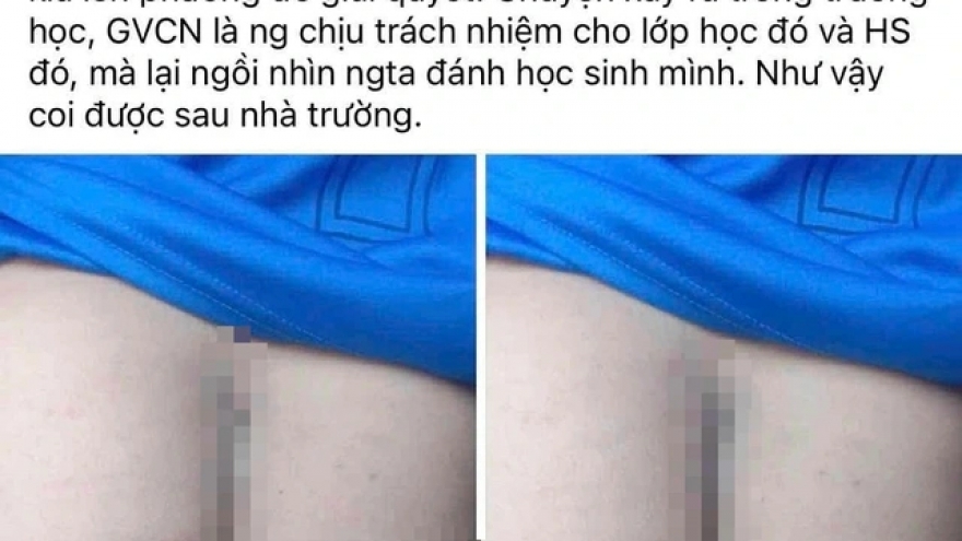 Vụ phụ huynh vào trường đánh học sinh: Tạm đình chỉ đứng lớp 2 giáo viên